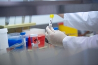 Τεστ αντισωμάτων Covid-19 θα μπορούν να κάνουν οι φοιτητές του ΕΜΠ στις 2 και 3 Νοεμβρίου!
